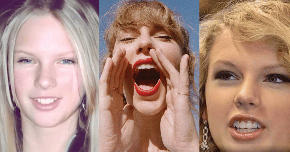 Taylor Swift reportedly got veneers after small accident in 2013.