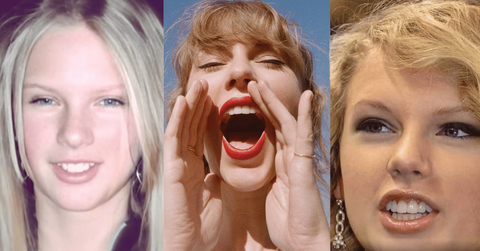 Taylor Swift reportedly got veneers after small accident in 2013.