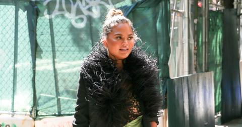 chrissy teigen gets fat removed from cheeks shows slimmer face i like it