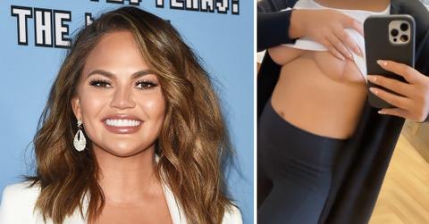 chrissy teigen shows scars from breast implant removal