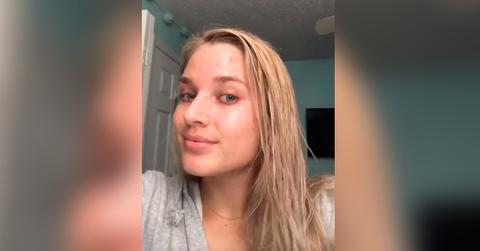 student goes viral with clever skincare hack using plasters to treat acne