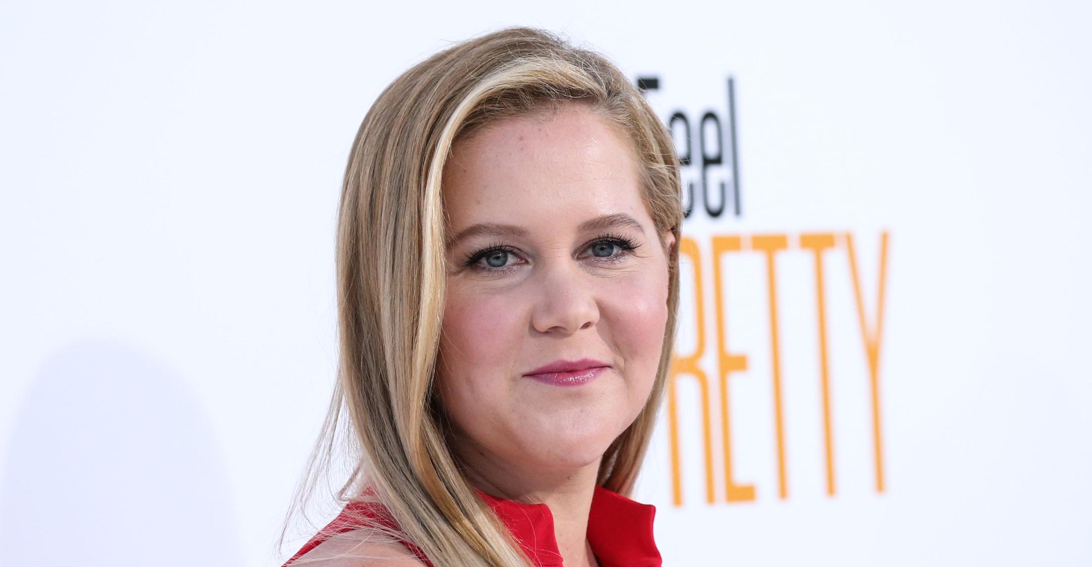 amy schumer liposuction face fillers dissolved