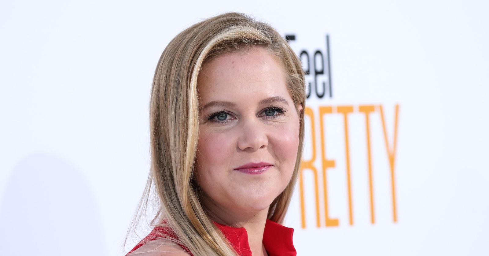 Amy Schumer Has Face Fillers Dissolved, Reveals She Got Liposuction