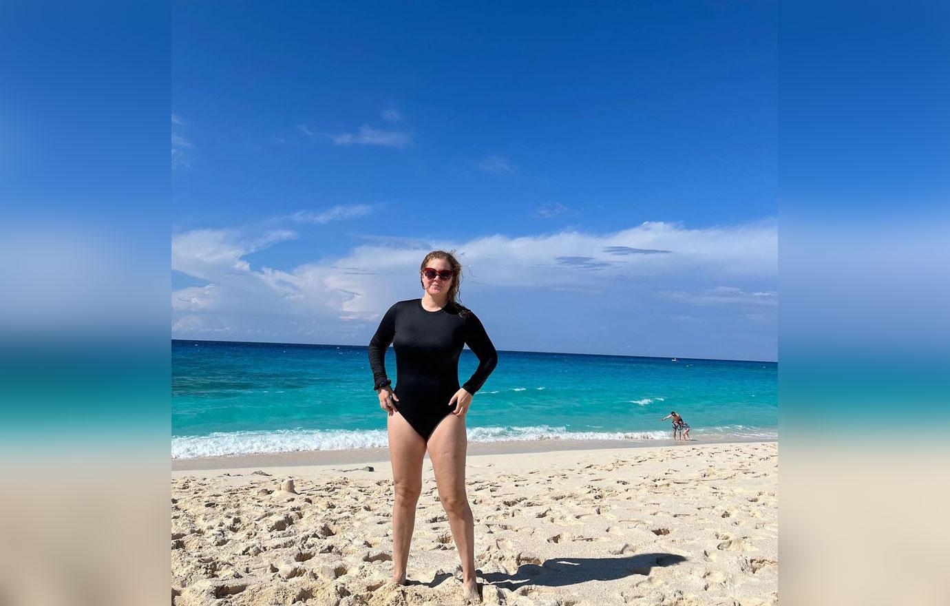 amy schumer liposuction photos new body