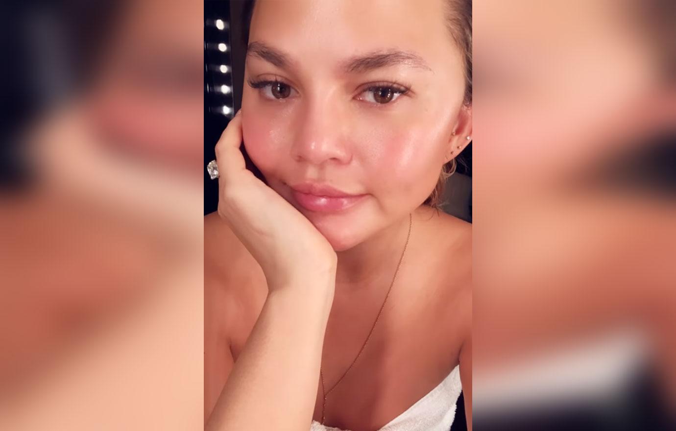 chrissy teigen new hairs eyebrow transplant surgery