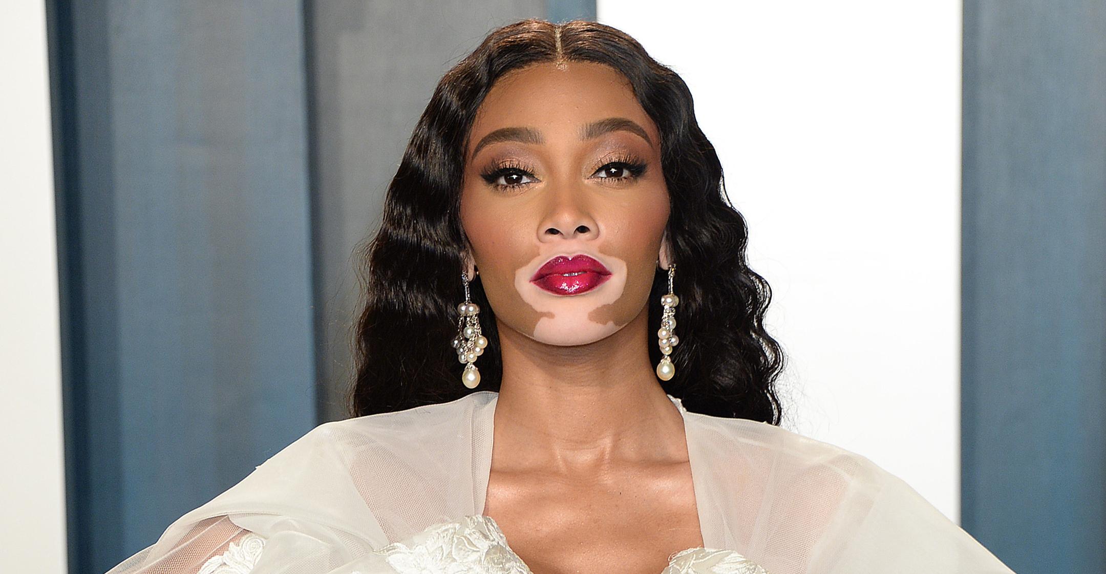 winnie harlow made to feel she couldnt succeed as model confidence helped persevere