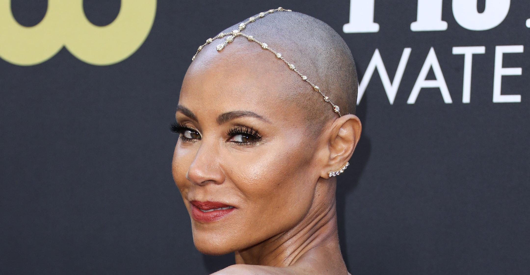 Jada Pinkett Smith: 10 things people with alopecia want you to