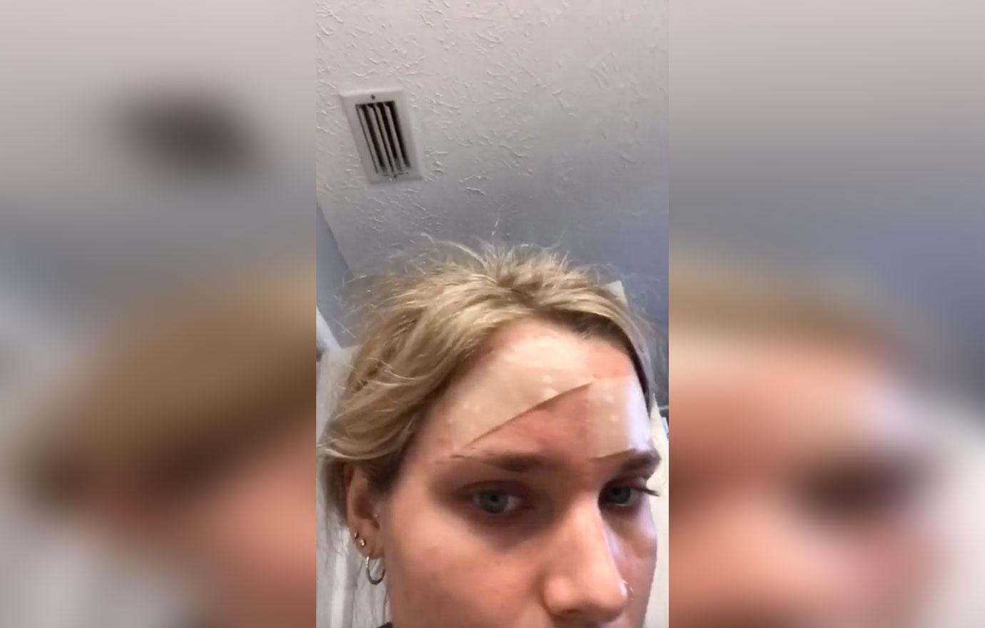 Bandages for acne? Experts weigh in on viral TikTok hack - ABC News