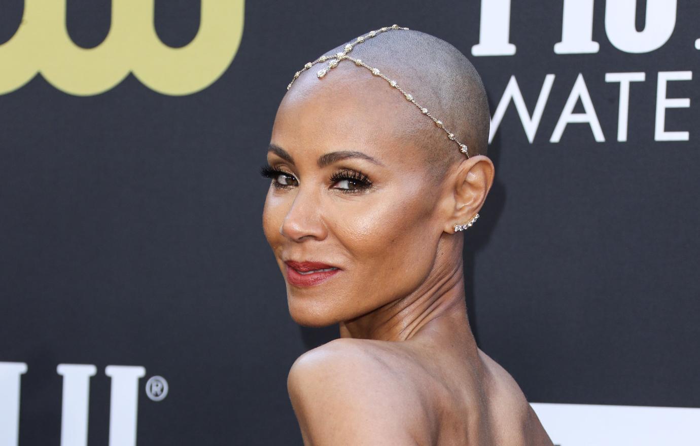 alopecia jada pinkett smith