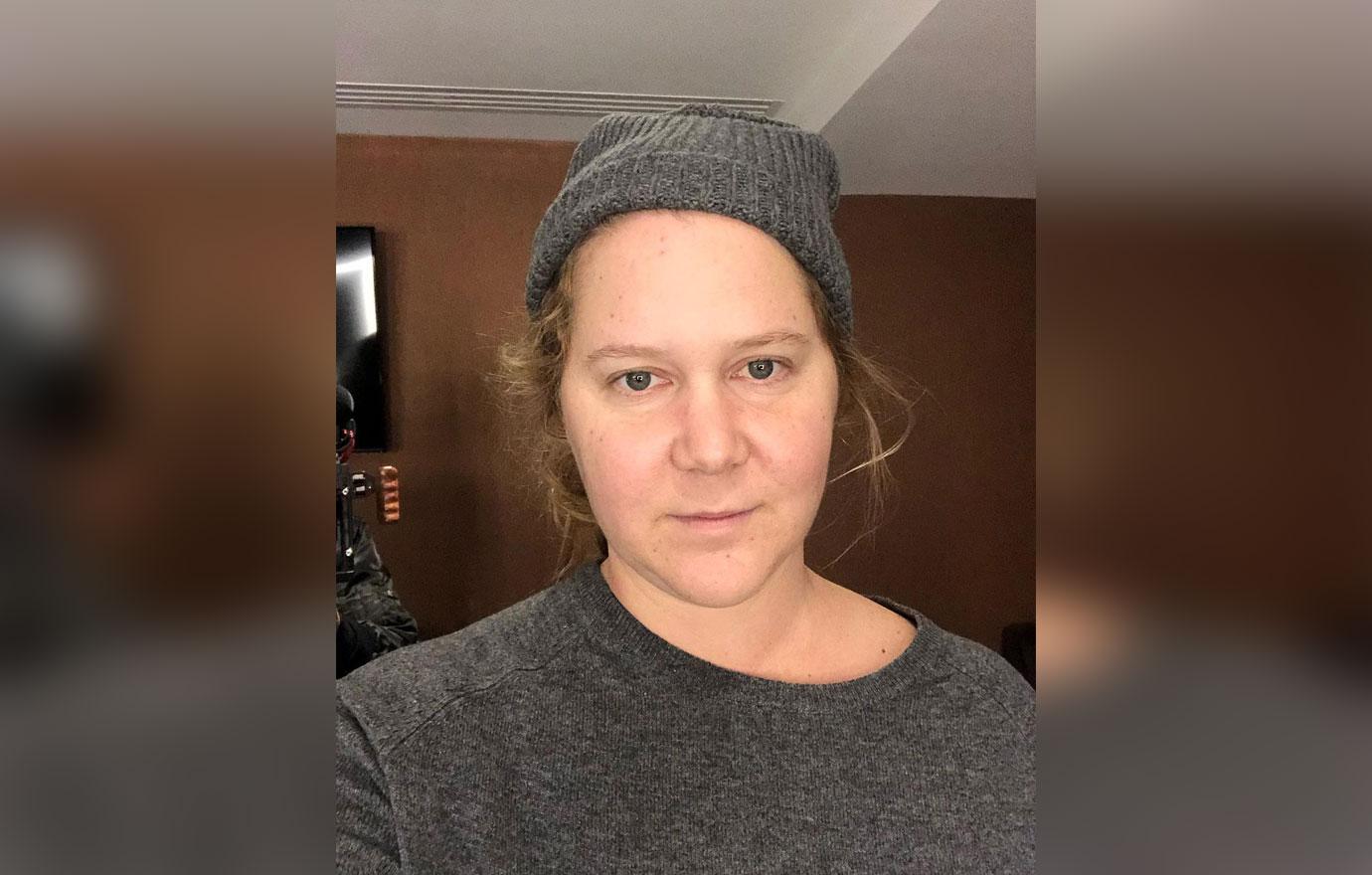 amy schumer posts selfie and talks about anxiety