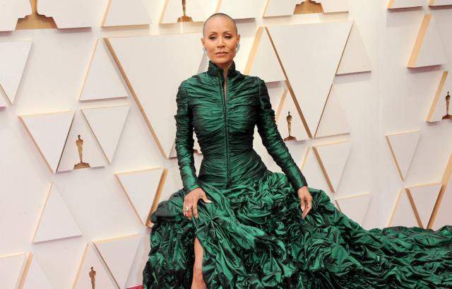 What Is Alopecia? Inside Jada Pinkett Smith's Medical Condition