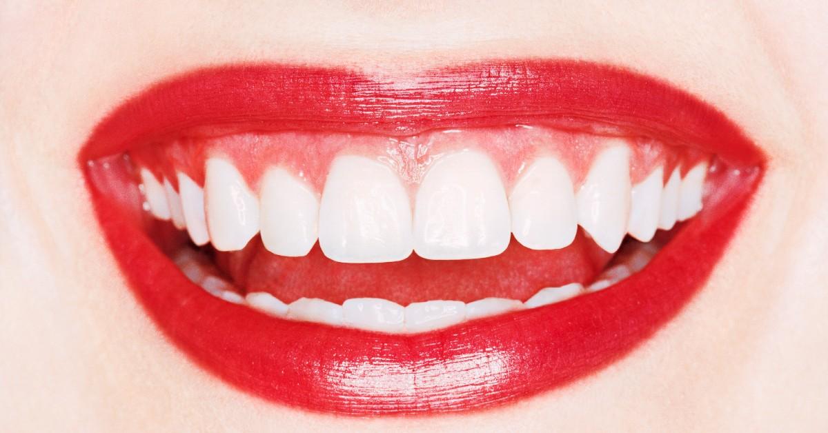 affordable teeth whitening shop