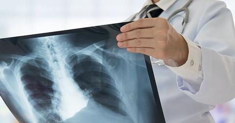 Photo of a doctor with an X-ray.