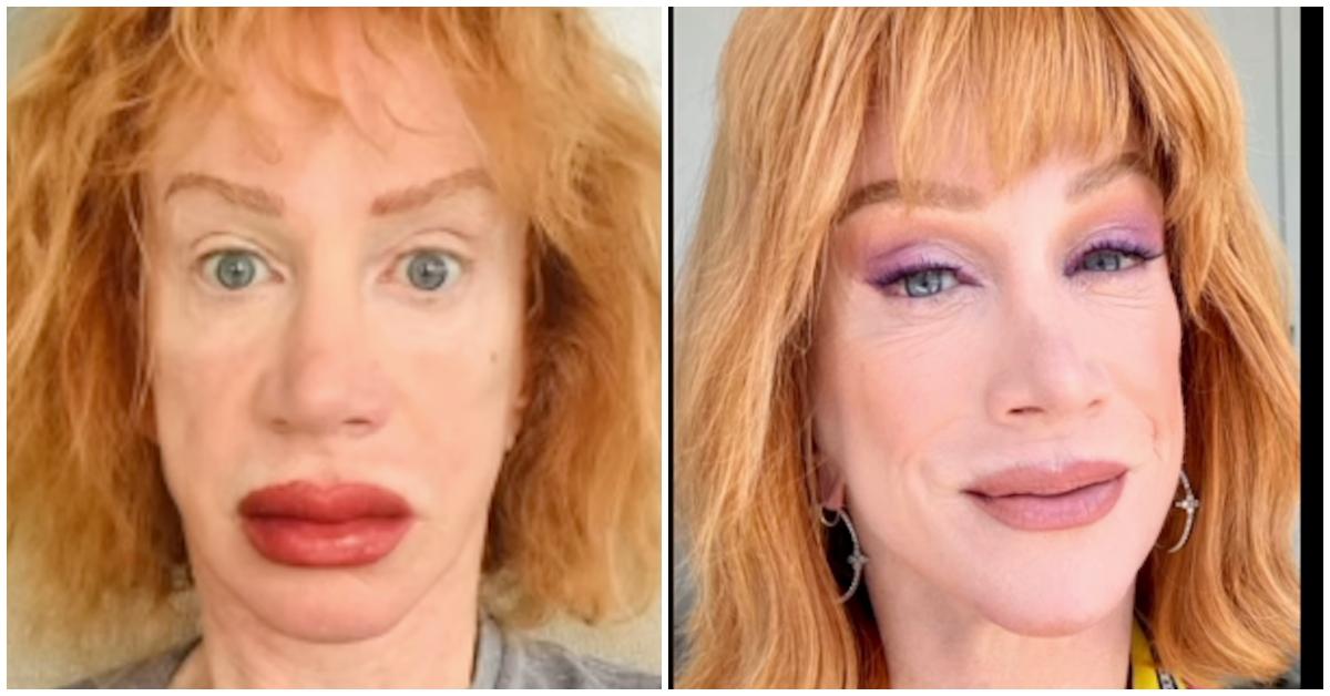 Kathy Griffin's Blushing Results Show Possibilities Of Lip Tattooing