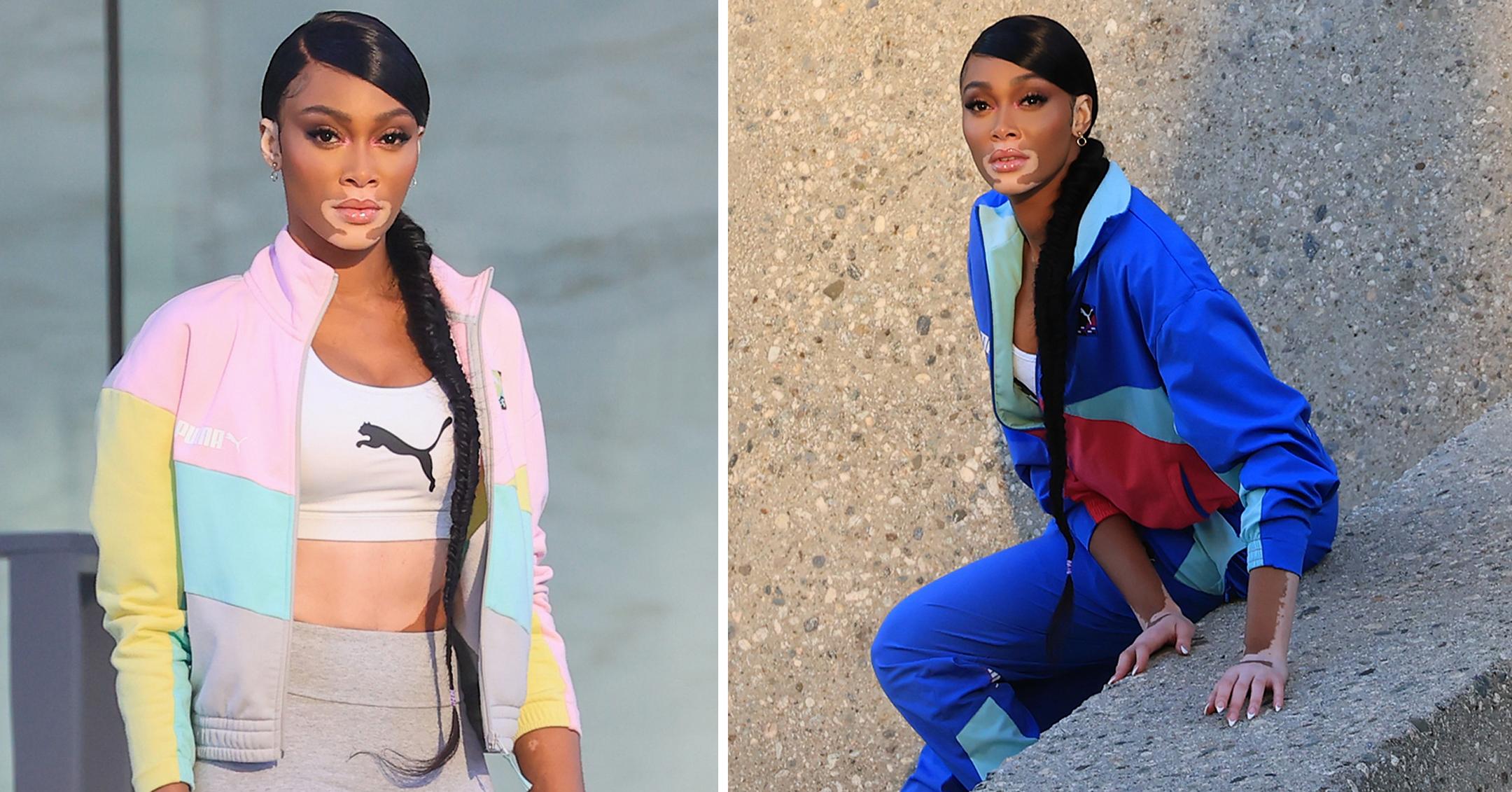 Model Winnie Harlow Rocks Athleisure Looks For PUMA Shoot: Photos